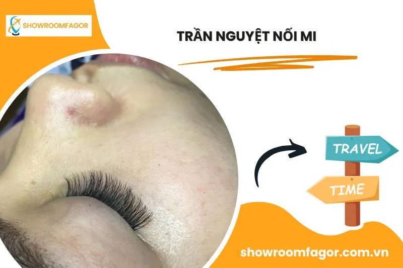 Trần Nguyệt Nối Mi