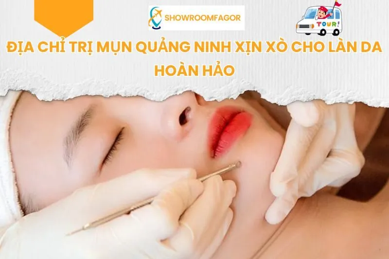 Địa Chỉ Trị Mụn Quảng Ninh Xịn Xò Cho Làn Da Hoàn Hảo