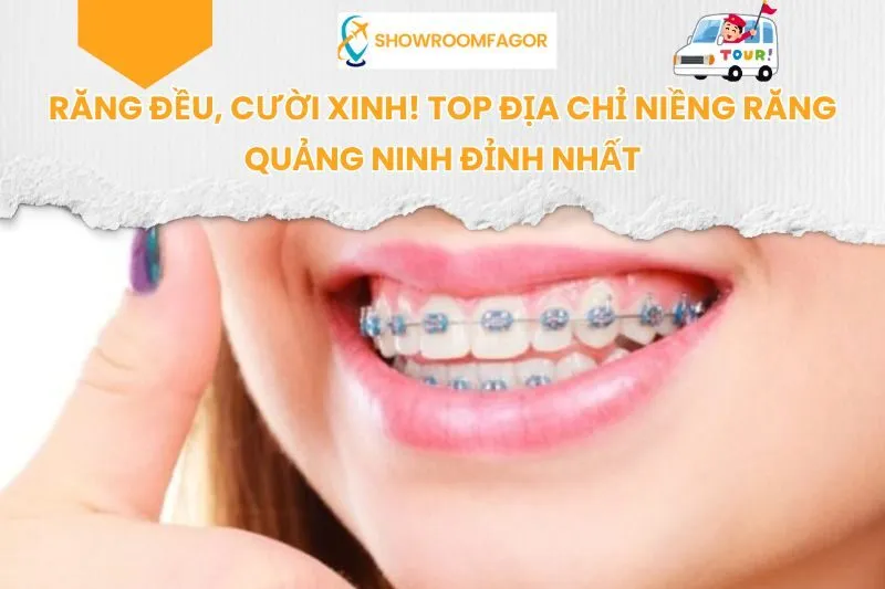 Răng Đều, Cười Xinh! Top Địa Chỉ Niềng Răng Quảng Ninh Đỉnh Nhất